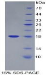 VEGF 121 Protein - Recombinant Vascular Endothelial Growth Factor 121 By SDS-PAGE