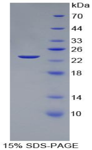 VEGF 145 Protein - Recombinant Vascular Endothelial Growth Factor 145 By SDS-PAGE