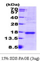 VEGFA / VEGF Protein