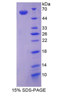 VG5Q / AGGF1 Protein - Recombinant Angiogenic Factor With G Patch And FHA Domains 1 By SDS-PAGE