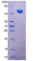 Vimentin Protein - Recombinant Vimentin (VIM) by SDS-PAGE