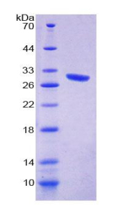 VWA1 / WARP Protein - Recombinant Von Willebrand Factor A Domain Containing Protein 1 By SDS-PAGE