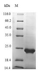 VWF / Von Willebrand Factor Protein - (Tris-Glycine gel) Discontinuous SDS-PAGE (reduced) with 5% enrichment gel and 15% separation gel.