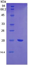 VWF / Von Willebrand Factor Protein - Recombinant Von Willebrand Factor By SDS-PAGE