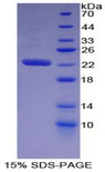 WARS Protein - Recombinant Tryptophanyl tRNA Synthetase By SDS-PAGE