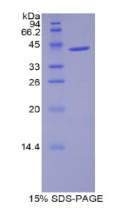 WFDC5 / PRG5 Protein - Recombinant WAP Four Disulfide Core Domain Protein 5 By SDS-PAGE