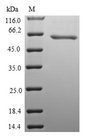 WNT8B / Wnt 8b Protein - (Tris-Glycine gel) Discontinuous SDS-PAGE (reduced) with 5% enrichment gel and 15% separation gel.