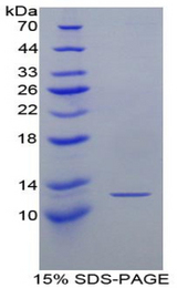 XCL1 / Lymphotactin Protein - Recombinant Lymphotactin By SDS-PAGE