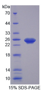 XCR1 Protein - Recombinant Chemokine C-Motif Receptor 1 By SDS-PAGE
