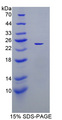 XDH / Xanthine Oxidase Protein - Recombinant  Xanthine Dehydrogenase By SDS-PAGE