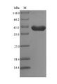 YWHAZ / 14-3-3 Zeta Protein - (Tris-Glycine gel) Discontinuous SDS-PAGE (reduced) with 5% enrichment gel and 15% separation gel.