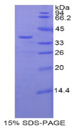 ZAP70 Protein - Recombinant Zeta Chain Associated Protein Kinase 70kDa By SDS-PAGE