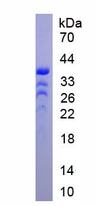 ZEB2 / SIP-1 Protein - Recombinant Zinc Finger Homeobox Protein 1B (ZFHX1B) by SDS-PAGE