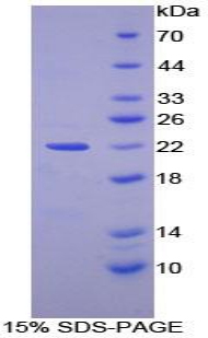 ZIF268 / EGR1 Protein