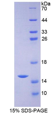 ZNT5 / SLC30A5 Protein - Recombinant Solute Carrier Family 30, Member 5 By SDS-PAGE