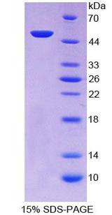 ZRP-1 / TRIP6 Protein - Recombinant  Thyroid Hormone Receptor Interactor 6 By SDS-PAGE