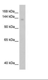 MOV10 Antibody - Transfected 293T Cell Lysate.  This image was taken for the unconjugated form of this product. Other forms have not been tested.
