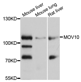 MOV10 Antibody - Western blot analysis of extracts of various cell lines.
