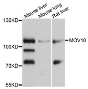 MOV10 Antibody - Western blot analysis of extracts of various cell lines.