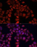 MOV10 Antibody - Immunofluorescence analysis of HeLa cells using MOV10 Polyclonal Antibody at dilution of 1:100.Blue: DAPI for nuclear staining.