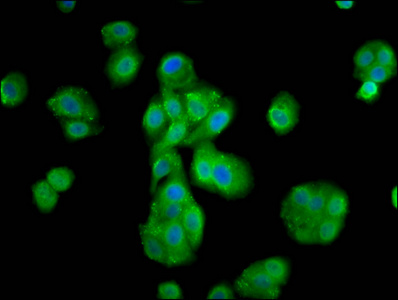 MOV10L1 Antibody - Immunofluorescence staining of HepG2 cells diluted at 1:133, counter-stained with DAPI. The cells were fixed in 4% formaldehyde, permeabilized using 0.2% Triton X-100 and blocked in 10% normal Goat Serum. The cells were then incubated with the antibody overnight at 4°C.The Secondary antibody was Alexa Fluor 488-congugated AffiniPure Goat Anti-Rabbit IgG (H+L).
