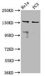 MOV10L1 Antibody - Western Blot Positive WB detected in: Hela whole cell lysate, PC3 whole cell lysate All Lanes: MOV10L1 antibody at 6.5µg/ml Secondary Goat polyclonal to rabbit IgG at 1/50000 dilution Predicted band size: 136, 38, 14, 130, 131 KDa Observed band size: 136 KDa