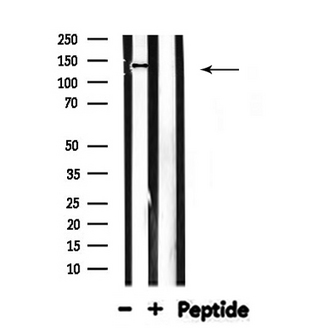 MOV10L1 Antibody - Western blot analysis of MOV10L1 expression in rat brain lysate 