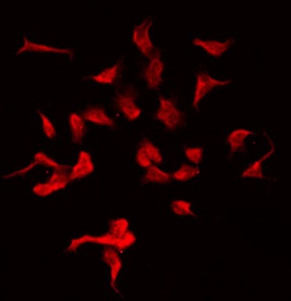 MOV10L1 Antibody - Staining HeLa cells by IF/ICC. The samples were fixed with PFA and permeabilized in 0.1% Triton X-100, then blocked in 10% serum for 45 min at 25°C. The primary antibody was diluted at 1:200 and incubated with the sample for 1 hour at 37°C. An Alexa Fluor 594 conjugated goat anti-rabbit IgG (H+L) Ab, diluted at 1/600, was used as the secondary antibody.