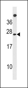 MPDU1 Antibody - MPDU1 Antibody western blot of NCI-H292 cell line lysates (35 ug/lane). The MPDU1 antibody detected the MPDU1 protein (arrow).