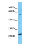 MPDU1 Antibody - Western blot of MPDU1 Antibody with human A549 Whole Cell lysate.  This image was taken for the unconjugated form of this product. Other forms have not been tested.