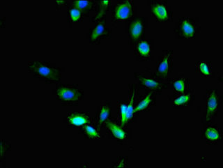MPDU1 Antibody - Immunofluorescent analysis of U251 cells using MPDU1 Antibody at dilution of 1:100 and Alexa Fluor 488-congugated AffiniPure Goat Anti-Rabbit IgG(H+L)