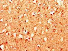 MPDU1 Antibody - Immunohistochemistry of paraffin-embedded human brain tissue using MPDU1 Antibody at dilution of 1:100
