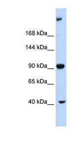 MPDZ / MUPP1 Antibody - MPDZ antibody Western blot of Fetal Liver lysate. This image was taken for the unconjugated form of this product. Other forms have not been tested.