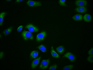MPEG1 Antibody - Immunofluorescence staining of A549 cells diluted at 1:166, counter-stained with DAPI. The cells were fixed in 4% formaldehyde, permeabilized using 0.2% Triton X-100 and blocked in 10% normal Goat Serum. The cells were then incubated with the antibody overnight at 4°C.The Secondary antibody was Alexa Fluor 488-congugated AffiniPure Goat Anti-Rabbit IgG (H+L).