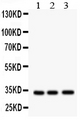 MPG Antibody - Western blot - Anti-MPG/Apng Antibody