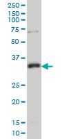 MPG Antibody - MPG monoclonal antibody (M04), clone 1E10 Western blot of MPG expression in HeLa NE.