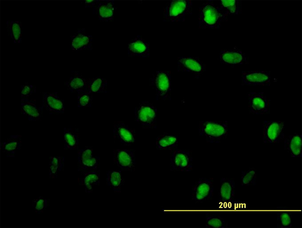 MPG Antibody - Immunofluorescence of monoclonal antibody to MPG on HeLa cell. [antibody concentration 10 ug/ml]