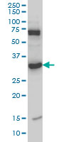 MPG Antibody - MPG monoclonal antibody (M07), clone 2C5 Western blot of MPG expression in HeLa NE.