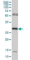MPG Antibody - MPG monoclonal antibody (M06), clone 2D2 Western blot of MPG expression in HeLa NE.
