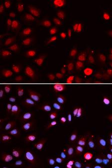 MPG Antibody - Immunofluorescence analysis of U2OS cells.