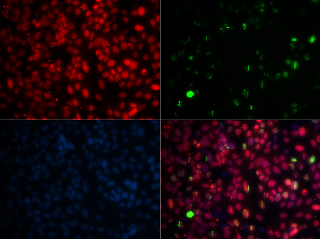 MPG Antibody - Immunofluorescence analysis of GFP-RNF168 transgenic U2OS cells.