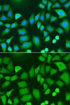 MPG Antibody - Immunofluorescence analysis of A549 cells.