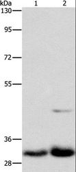 MPG Antibody - Western blot analysis of Lovo and PC3 cell, using MPG Polyclonal Antibody at dilution of 1:950.