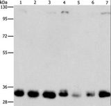 MPG Antibody - Western blot analysis of 231, 293T, Lovo, hepG2, A549, PC3 and A172 cell, using MPG Polyclonal Antibody at dilution of 1:1500.