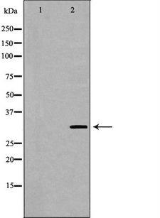 MPG Antibody - Western blot analysis of K562 whole cells lysates using MPG antibody. The lane on the left is treated with the antigen-specific peptide.