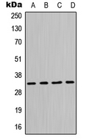 MPG Antibody - Western blot analysis of MPG expression in Jurkat (A); HeLa (B); Raw264.7 (C); PC12 (D) whole cell lysates.