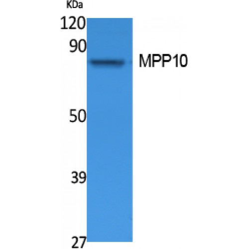MPHOSPH10 / MPP10 Antibody - Western blot of MPP10 antibody