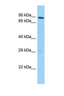 MPHOSPH10 / MPP10 Antibody - MPHOSPH10 antibody Western blot of Mouse Thymus lysate. Antibody concentration 1 ug/ml.  This image was taken for the unconjugated form of this product. Other forms have not been tested.