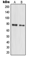 MPHOSPH10 / MPP10 Antibody - Western blot analysis of MPP10 expression in HeLa (A); MCF7 (B) whole cell lysates.