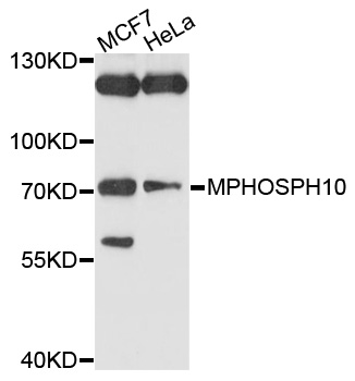 MPHOSPH10 / MPP10 Antibody - Western blot analysis of extracts of various cell lines, using MPHOSPH10 antibody at 1:1000 dilution. The secondary antibody used was an HRP Goat Anti-Rabbit IgG (H+L) at 1:10000 dilution. Lysates were loaded 25ug per lane and 3% nonfat dry milk in TBST was used for blocking. An ECL Kit was used for detection and the exposure time was 90s.